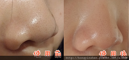 前後對照圖.png 試用