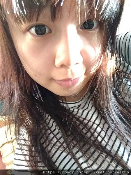 玻尿酸 試用