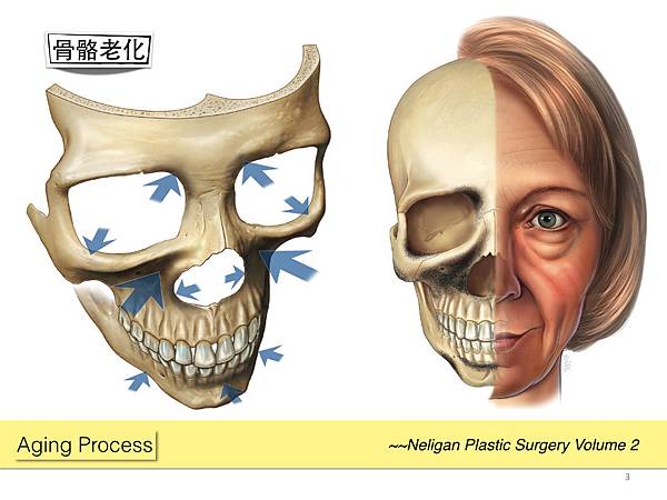 [抗老新知] "姊，你真的老到”骨子"裡去了？！”～談老化的全面性過程-3