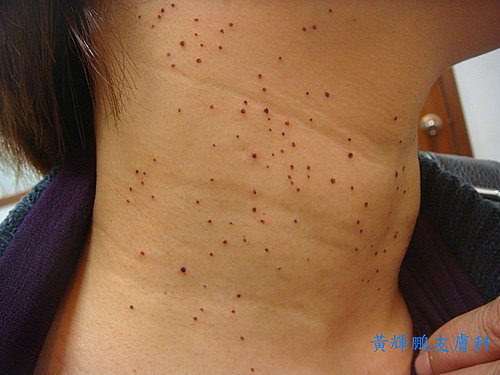 d4e152949126a7acea8e90422486c193 d4e152949126a7acea8e90422486c193