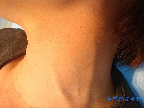 5f7cf34ee3b44411fcf5fefd506b31a3 5f7cf34ee3b44411fcf5fefd506b31a3