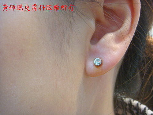 穿耳洞藝術與安全 美麗讓生活更美麗 痞客邦 穿耳洞藝術與安全 美麗讓生活更美麗 痞客邦