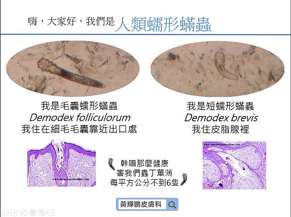 Demodex pixnet 3.jpg Demodex pixnet 3.jpg
