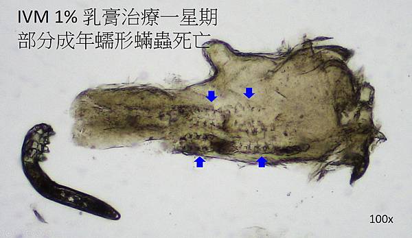 Demodex pixnet 9.jpg Demodex pixnet 9.jpg