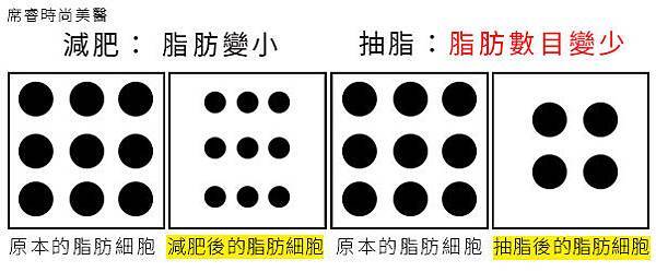 抽脂費用抽脂價格抽脂手術超音波抽脂減肥塑身超音波抽脂推薦抽脂 推薦 大腿抽脂腹部抽脂黃金z波抽脂抽脂推薦席睿時尚美醫診所瘦身04 抽脂費用抽脂價格抽脂手術超音波抽脂減肥塑身超音波抽脂推薦抽脂 推薦 大腿抽脂腹部抽脂黃金z波抽脂抽脂推薦席睿時尚美醫診所瘦身04