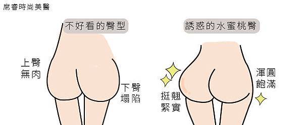 抽脂費用抽脂價格抽脂手術塑身抽脂 推薦 黃金z波抽脂抽脂推薦席睿時尚美醫診所瘦身體雕豐臀蜜桃臀標靶震波橘皮UltraShape標靶震波溶脂腰窩02.jpg