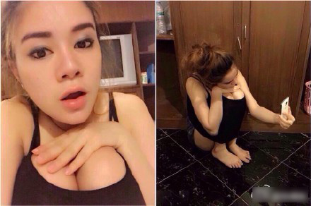 高雄席睿自體脂肪移植多少錢隆乳多少錢平價好不好黃金z波脂雕多少錢 (2) 高雄席睿自體脂肪移植多少錢隆乳多少錢平價好不好黃金z波脂雕多少錢 (2)