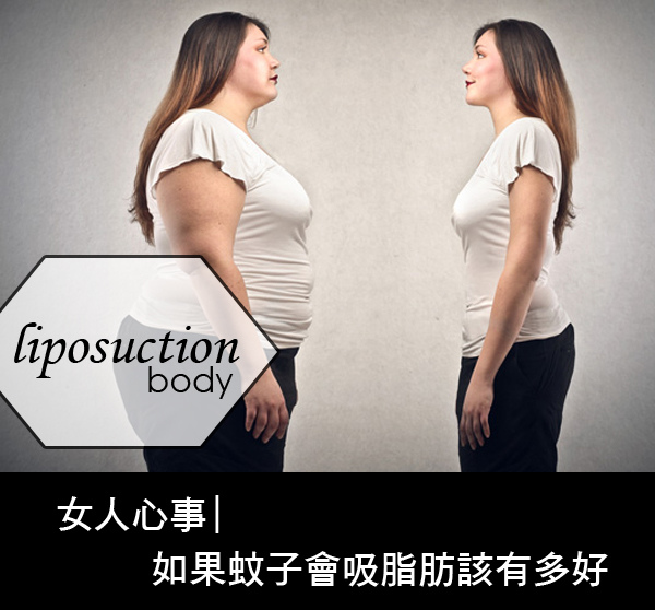 抽脂費用抽脂價格抽脂手術超音波抽脂減肥塑身超音波抽脂推薦抽脂 推薦 大腿抽脂腹部抽脂黃金z波抽脂抽脂推薦席睿時尚美醫診所瘦身主圖