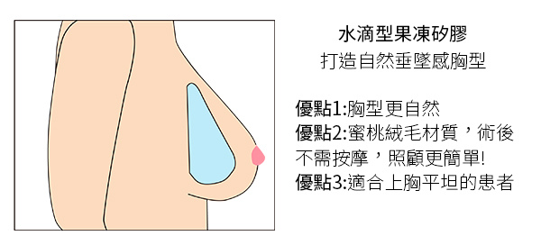 高雄隆乳豐胸醫生推薦診所整形外科席睿時尚美醫高雄水滴型矽膠隆乳多少錢價格價位自然嗎隆乳術後副作用 (5).jpg 高雄隆乳豐胸醫生推薦診所整形外科席睿時尚美醫高雄水滴型矽膠隆乳多少錢價格價位自然嗎隆乳術後副作用 (5).jpg