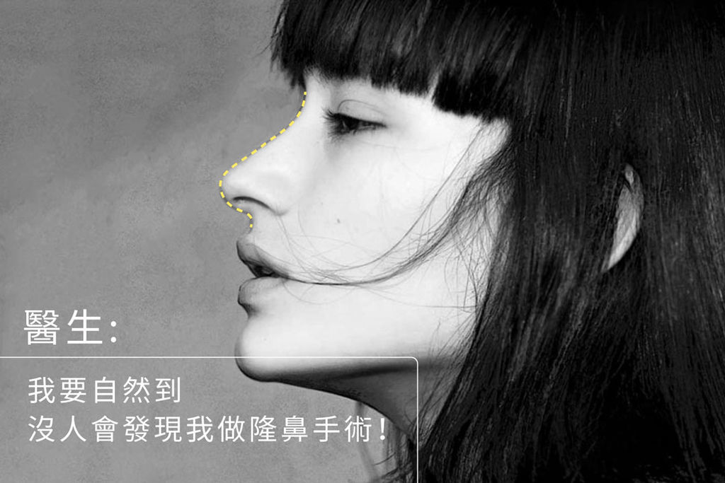 高雄隆鼻經口式隆鼻隱痕隆鼻推薦王文禾醫生席睿時尚美醫隆鼻價格評價費用案例照術後 01.jpg 高雄隆鼻經口式隆鼻隱痕隆鼻推薦王文禾醫生席睿時尚美醫隆鼻價格評價費用案例照術後 01.jpg