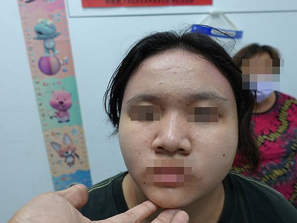 face after.jpg face after.jpg