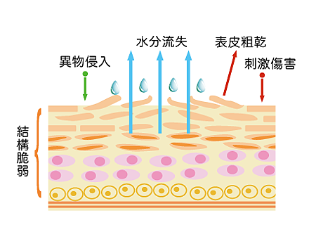 CERAMIDE不足.png