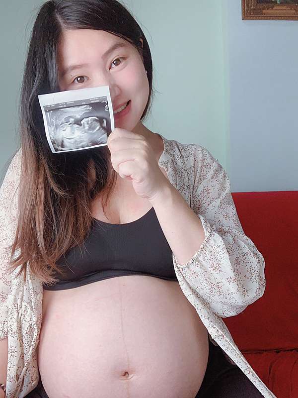 孕期保養 媽咪莉娜maternea 彈力潤膚油 妊娠油 無痕美體霜 妊娠霜 藝人一致好評的懷孕好幫手 花蓮旅遊張小敏 痞客邦