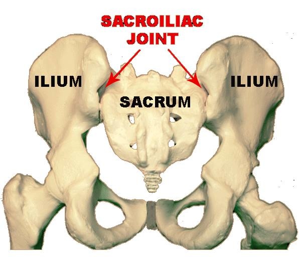 薦髂關節疼痛 Sacroiliac Joint Pain Si Pain 黃郁翔物理治療所院長 黃郁翔物理治療所 痞客邦