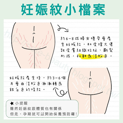 妊娠紋怎麼生成的