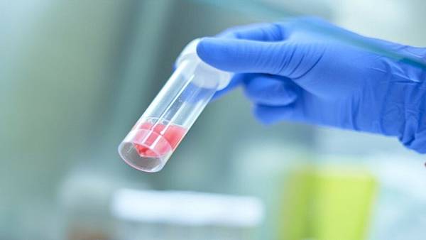 預防未來疾病的利器，臍帶血的潛力解析