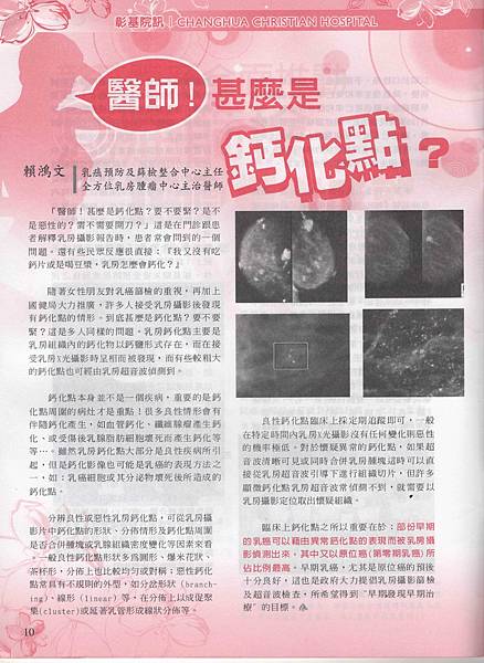 乳房鈣化點處理