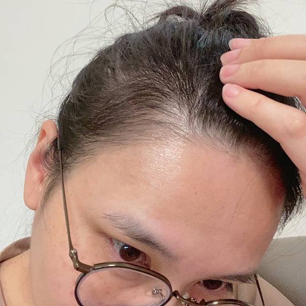 【孕後日記】產後掉髮的養護路程(自製生髮水精油配方) 【孕後日記】產後掉髮的養護路程(自製生髮水精油配方)