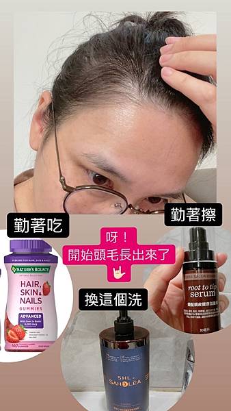 【孕後日記】產後掉髮的養護路程(自製生髮水精油配方) 【孕後日記】產後掉髮的養護路程(自製生髮水精油配方)