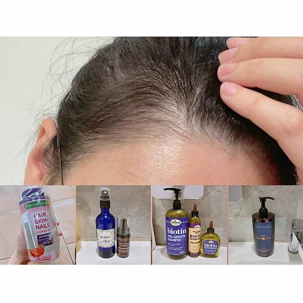 【孕後日記】產後掉髮的養護路程(自製生髮水精油配方) 【孕後日記】產後掉髮的養護路程(自製生髮水精油配方)