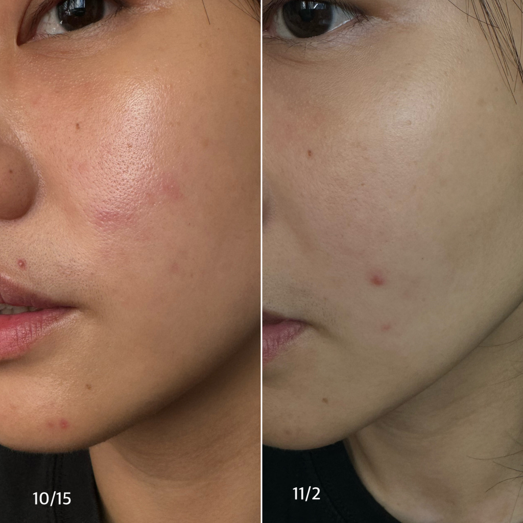 【美妝保養】Cerave A醇勻亮修護精華 實測2週心得