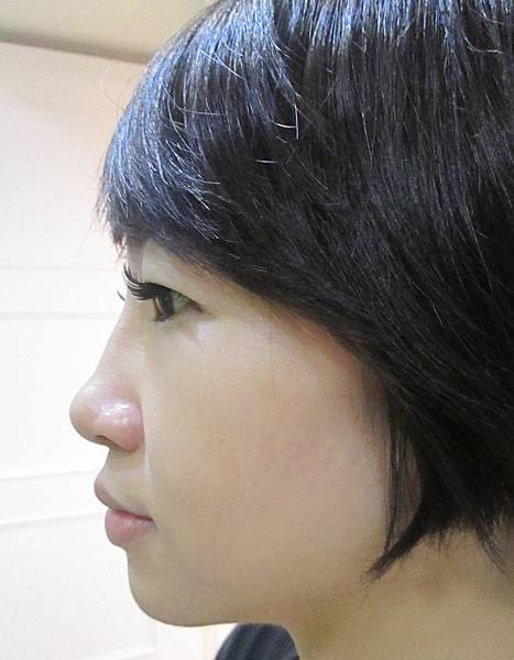 140913abby術後修.jpg 140913abby術後修.jpg