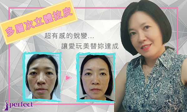 螢幕快照 2017-08-11 上午10.40.12.png