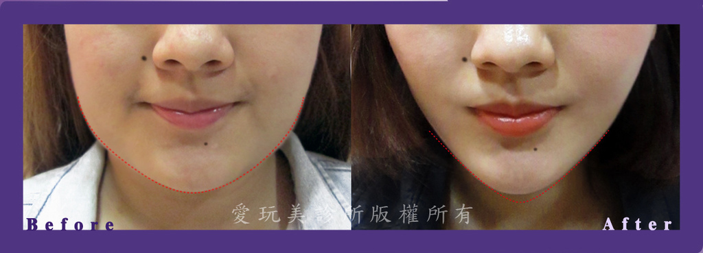 少女線_Eva.jpg 少女線_Eva.jpg