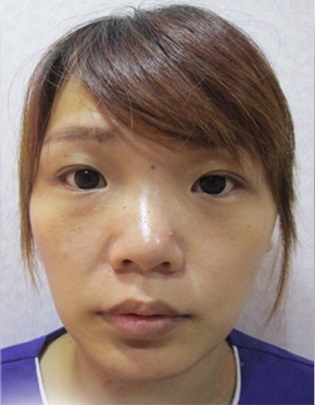 小Q-BA.jpg 小Q-BA.jpg