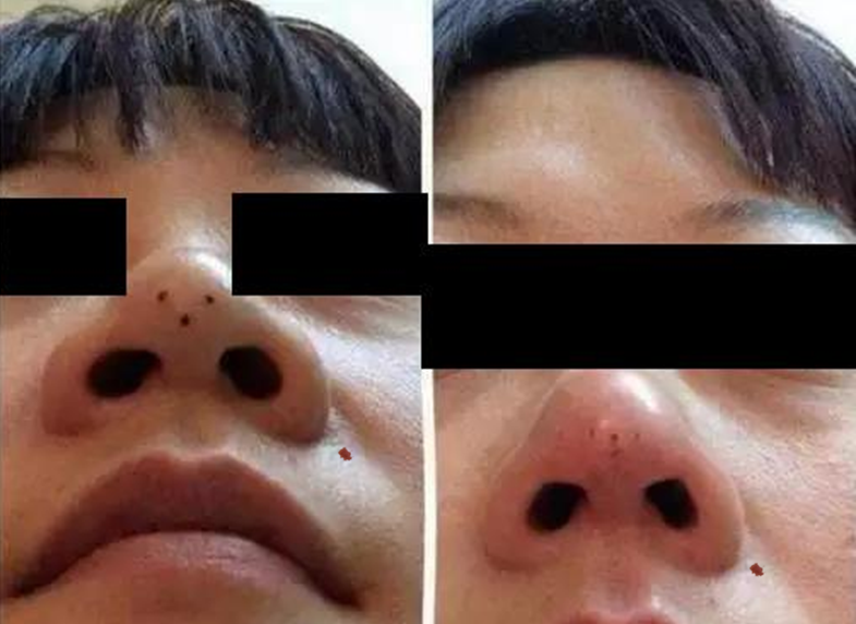 鼻雕.png 鼻雕.png