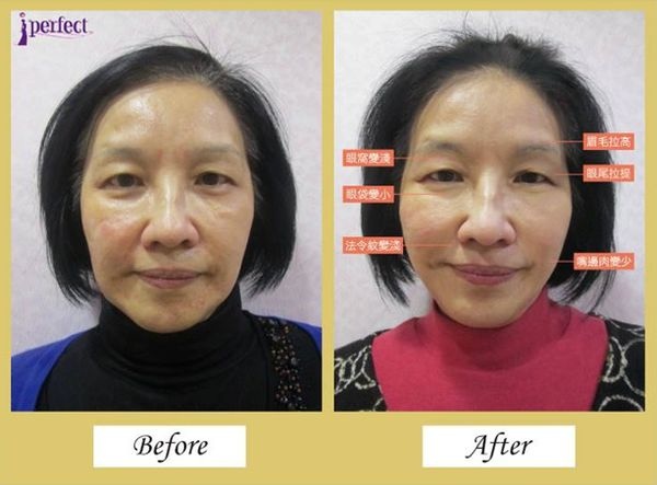 劉芳玲醫師.jpg 劉芳玲醫師.jpg