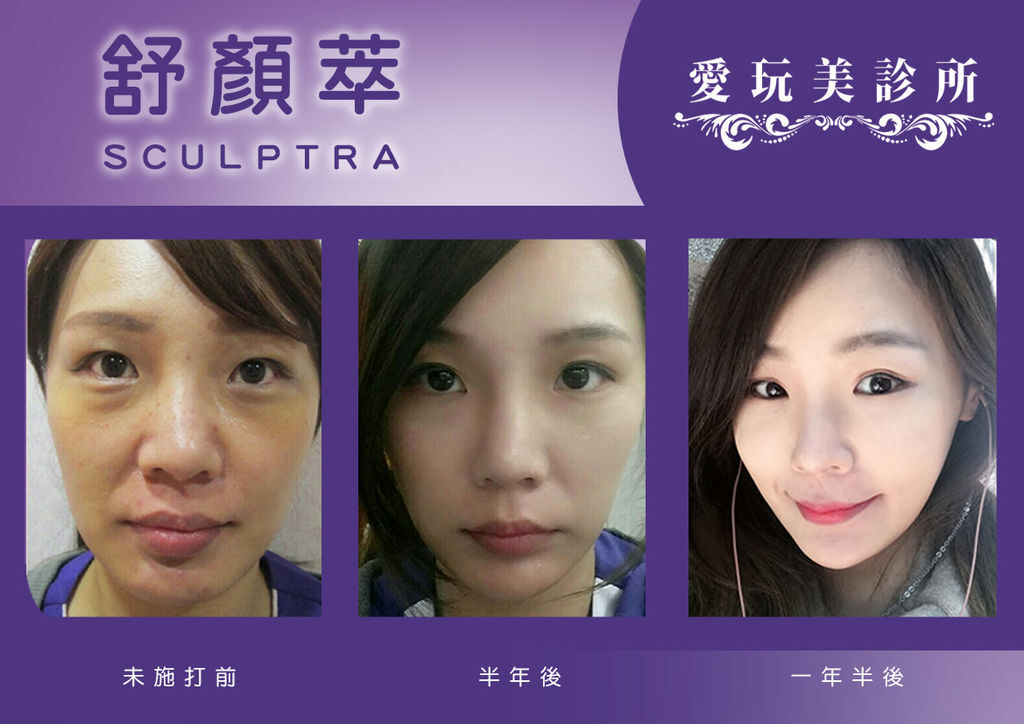 舒顏萃小Q.jpg 舒顏萃小Q.jpg