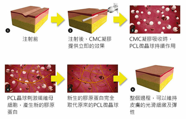 洢蓮絲PCL完美晶球塑造臉部線條美