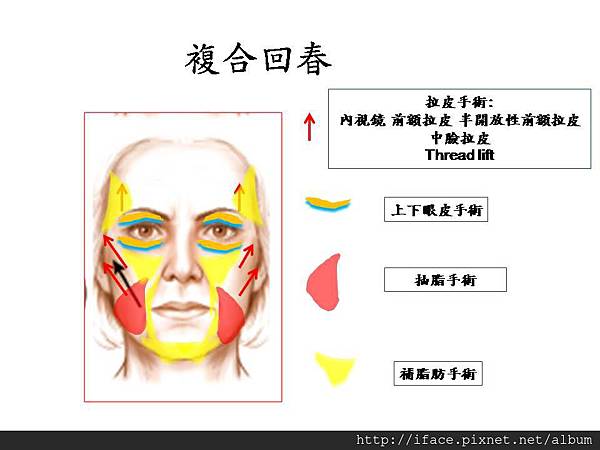 複合回春