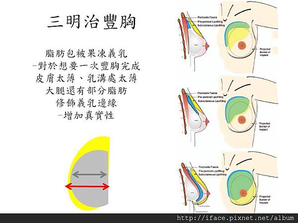 投影片12