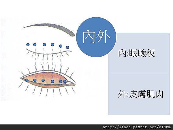 定書針雙眼皮