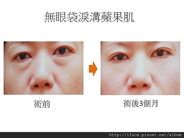 投影片6 投影片6