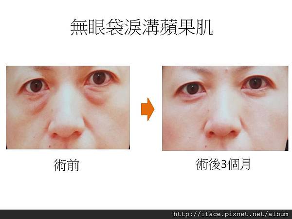 投影片7 投影片7