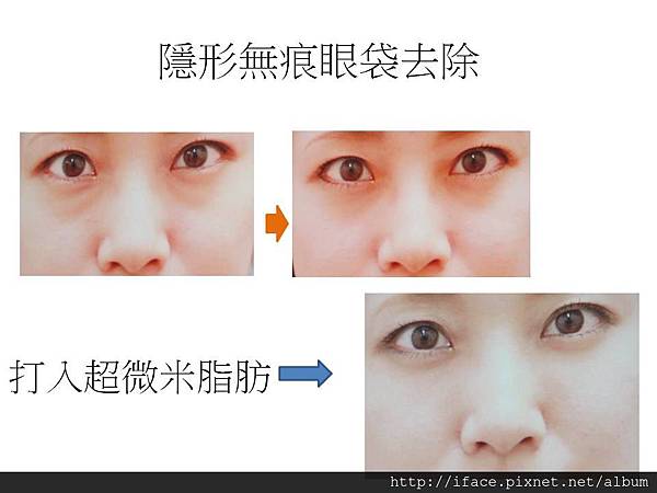 投影片4 投影片4