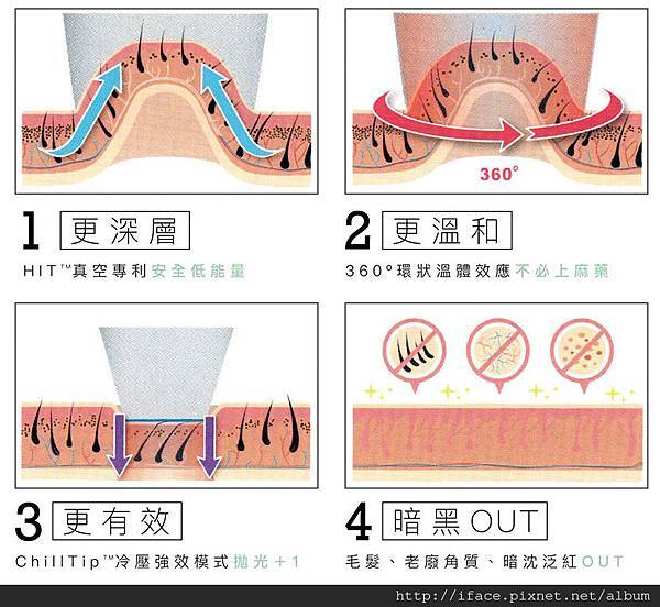 新竹/台中 『真空除毛』推薦 基尼線除毛VIO私密除毛 K