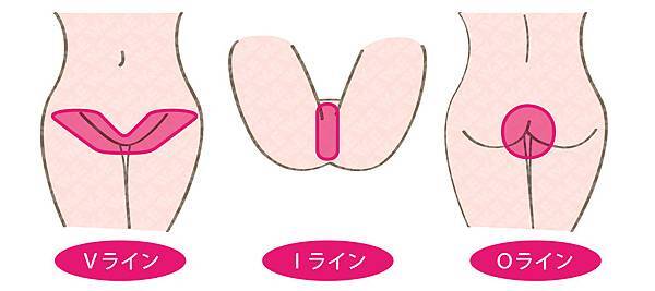 新竹/台中 『真空除毛』推薦 基尼線除毛VIO私密除毛 K 新竹/台中 『真空除毛』推薦 基尼線除毛VIO私密除毛 K