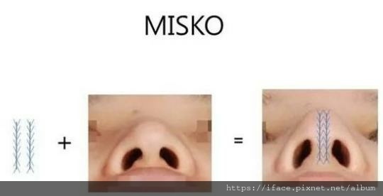 鼻埋線5 鼻埋線5