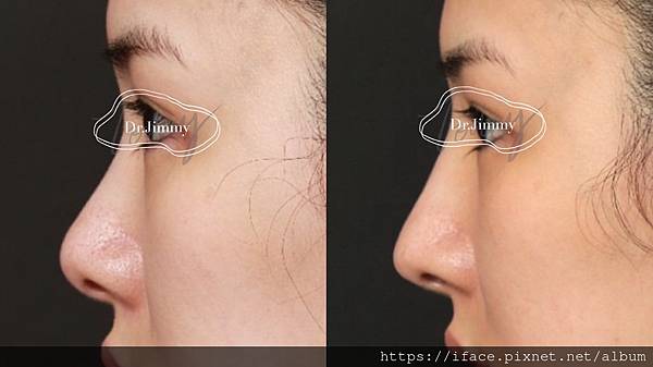 台中鼻雕 台中鼻雕