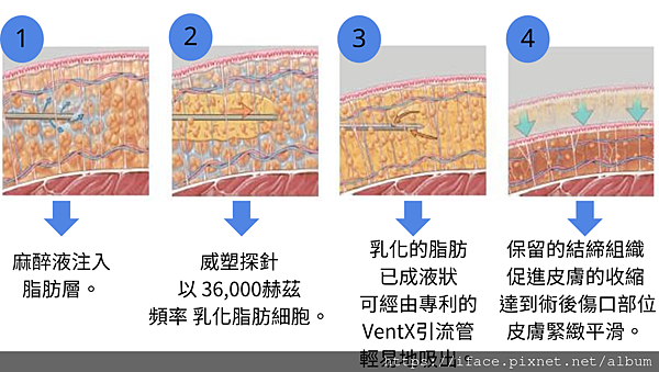 威塑原理