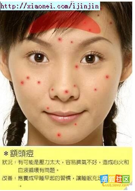 額頭痘 額頭痘