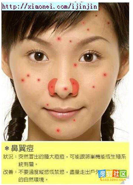 鼻翼痘 鼻翼痘