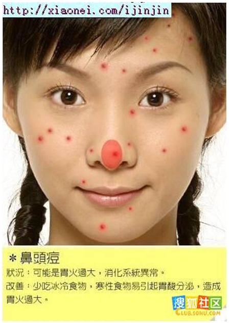 鼻頭痘 鼻頭痘