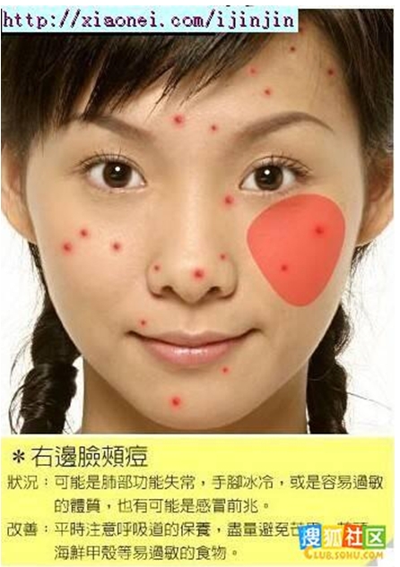 右臉痘 右臉痘