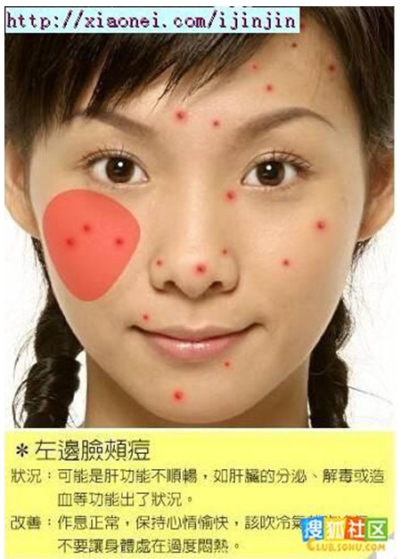 左臉痘 左臉痘
