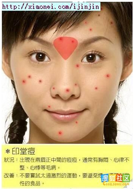 印堂痘 印堂痘